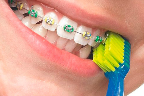 Как правильно чистить зубы зубной щеткой: практические советы и рекомендации